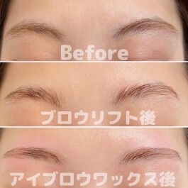 【大人気♪】ブロウリフトとは??